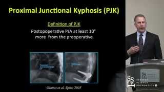 Proximal Junctional Kyphosis and Failure by Darrel S Brodke MD [upl. by Pritchett]