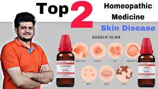 Top 2 Homeopathic Medicine for Skin  चर्म रोग की सबसे बेहतरीन दो होम्योपैथिक दवा [upl. by Joannes]