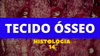 TECIDO ÓSSEO  HISTOLOGIA 14 [upl. by Elia]