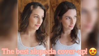 The BEST Coverup for Alopecia Areata uniwigsofficial Hair Patches [upl. by Suirred]