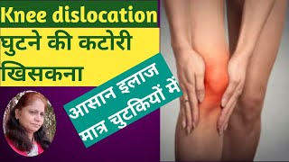 Knee dislocation  Easy treatment without any surgery [upl. by Lonny]