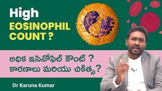 Reasons for High Eosinophil Counts  How to Reduce Eosinophils  Dr Karuna Kumar Hematologist [upl. by Mitman]