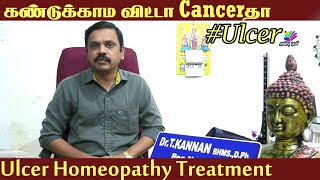 Ulcer கவனிக்காம விட்டா Cancerஆ மாறிடும்  Ulcer Homeopathy Treatment  Health Tips In Tamil  AnbuTv [upl. by Moncear]