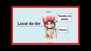 Symptome und wie man Kniesehnenentzündung behandelt [upl. by Mehalek]