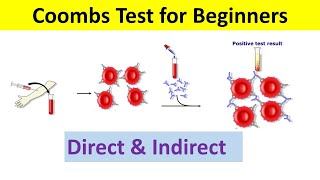 Indirect and direct Antiglobulin test Coombs test  direct and indirect  Panmedicad [upl. by Einre]