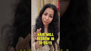 Stop Hair Fall amp Regrow Hair in 10 Days In Monsoon  Suman Pahuja  Shorts haircare hair [upl. by Iv]