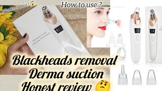 Blackheads removal pore cleaner device Honest Review 😱 blackheadremoval reviews [upl. by Laryssa]