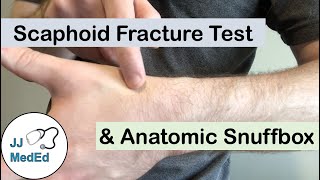 Scaphoid Fracture Test Clinical Exam and the Anatomic Snuffbox [upl. by Ahtelat719]