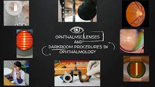 Ophthalmic lenses and Darkroom procedures in Ophthalmology [upl. by Aicertap852]