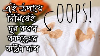 এই সহজ উপায়ে দূর করুন কাপড়ের কঠিন দাগ  how to remove clothes stain  kapore dag tolar upay [upl. by Enaek409]