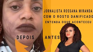 Oque Aconteceu com a Jornalista da Tpa quotRossana Mirandaquot  Entendo Tudo [upl. by Hayouqes]