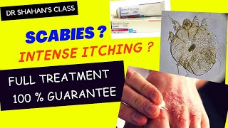 Scabies Treatment  100  sure treatment scabies treatmentplan dermatology [upl. by Leahcar779]