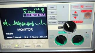 Zoll ESeries Patient Alarm Tone [upl. by Viccora]