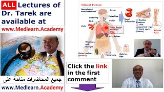 Subacute Bacterial Endocarditis SBE cme internalmedicine usmle medical ecg محاضراتباطنة [upl. by Pachton411]