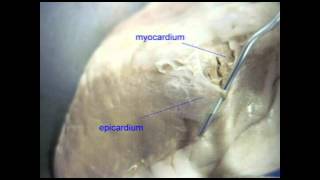 AP2 EXAM 1 HEART EPICARDIUMavi [upl. by Joanne]