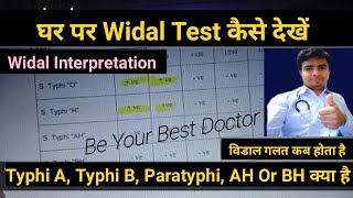 Widal Test In Hindi  विडाल टेस्ट  Widal Test Report Reading In Hindi  Typhoid Fever Test [upl. by Ainocal]