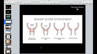 Induction of Labour  OB course  Masterclass Medicine [upl. by Borszcz]