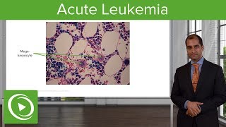 Acute Leukemia Etiology amp Subtypes – Pathology  Lecturio [upl. by Udell]