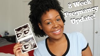 8 Week Pregnancy Update  Ultrasound Symtoms amp More [upl. by Myrah129]