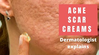 Acne Scar Creams  Dermatologist Reviews [upl. by Thun545]