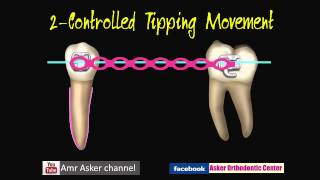 Types of Orthodontic Tooth movement [upl. by Nailliw664]