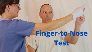 FingertoNose Test [upl. by Carlson]