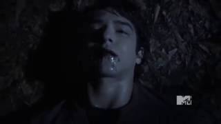 Teen Wolf DrDeaton Save Scott McCall Life in the wood Season1Episode10 [upl. by Maureen]