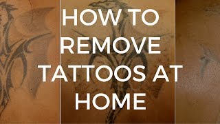 How To Remove Tattoos at Home Using a TCA Peel [upl. by Kylah]