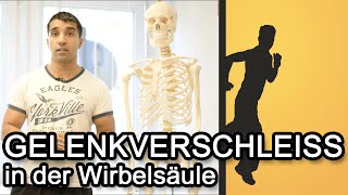 Gelenkverschleiss in der Wirbelsäule  Spondylarthrose  Facettengelenksyndrom [upl. by Halet885]