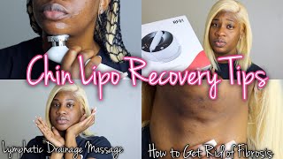 How To Get Rid Of Fibrosis For Chin Lipo Post OP Care amp Products Lymphatic Drainage Massage At Home [upl. by Ayotl]