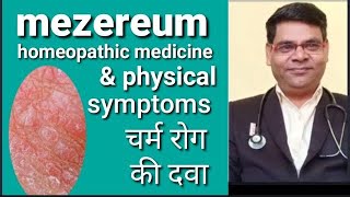 Mezereum 30  Mezereum 200  Mezereum 1m  mezereum homeopathic medicine uses in hindi [upl. by Idelson465]