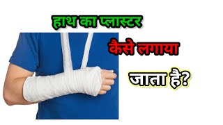 How to Apply POP COST FOR WRIST JOINT [upl. by Evanthe]