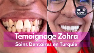 Témoignage Couronnes et Implant Dentaire en Turquie Zohra [upl. by Aivatal]