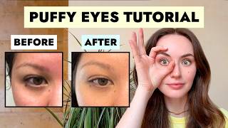 What To Do Against Puffy Eyes [upl. by Eirellam]