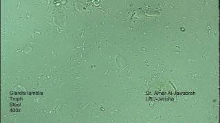 Giardia lamblia intestinalis trophozoite [upl. by Gilmour]