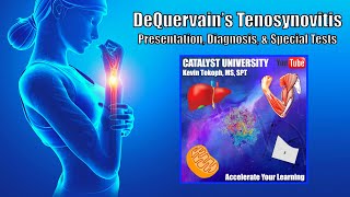 DeQuervains Tenosynovitis  Snuffbox Anatomy Diagnosis amp Special Tests [upl. by Kenzi]