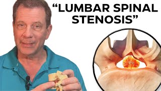 7 Step NonSurgical Treatment For Lumbar Spinal Stenosis  Dr John Zielonka Chiropractor In Ottawa [upl. by Lindy]