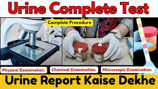 Urine Examination Test  Urine Test Report Kaise dekhe  Microscopic Examination of Urine urinary [upl. by Corbin310]