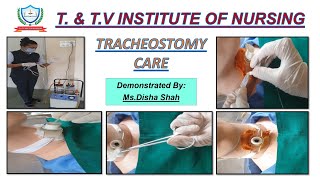 Tracheostomy care [upl. by Lowry]