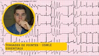 Torsades de pointes USMLE  Avoid any mistakes [upl. by Alic]