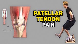 3 Exercises for Jumper’s Knee Patellar Tendinopathy [upl. by Oirelav890]