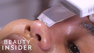 I Got My Blackheads Professionally Extracted For 235  Beauty Explorers  Beauty Insider [upl. by Mace]