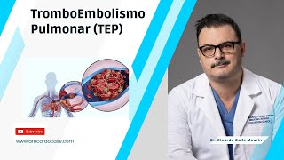 Tromboembolismo Pulmonar TEP  Signos y Síntomas  Complicaciones [upl. by Oilicec]