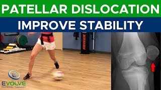 Patellar Dislocation  Improving Dynamic Knee Stability  Part 1 [upl. by Iznil]