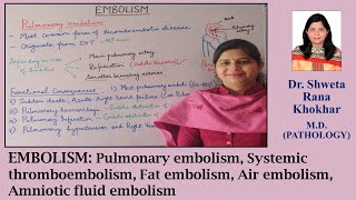 EMBOLISM  Pulmonary Systemic Thromboembolism Fat Air Amniotic Fluid Embolism [upl. by Zehcnas]