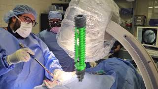 Truth About Sacroiliac Joint Fixation HarvardTrained Spine Surgeon Dr Kingsley R Chin Explains [upl. by Carol-Jean119]