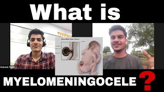 What is Myelomeningocele Watch Full Story of Patient  Ashishsharmavlogsofficial spinalcord [upl. by Gomer832]