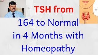 Thyroid cured by Dr Ketan Shah  TSH 164 to Normal  Only Homeopathy [upl. by Ahsiemac]