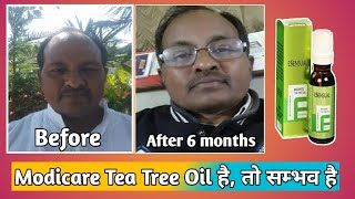 Modicare Tea Tree Oil है तो सम्भव है अब बालों का उगना होगा सुरू [upl. by Silda424]