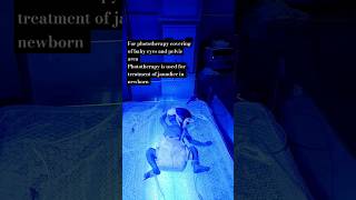 Phototherapy in jaundice✨youtube nursing hospitalequipment motivation nurshing doctorstatus [upl. by Dianne]